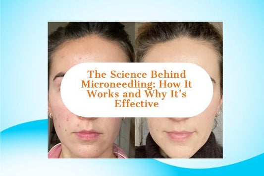 The Science Behind Microneedling: How It Works and Why It’s Effective - LushnLavish.com
