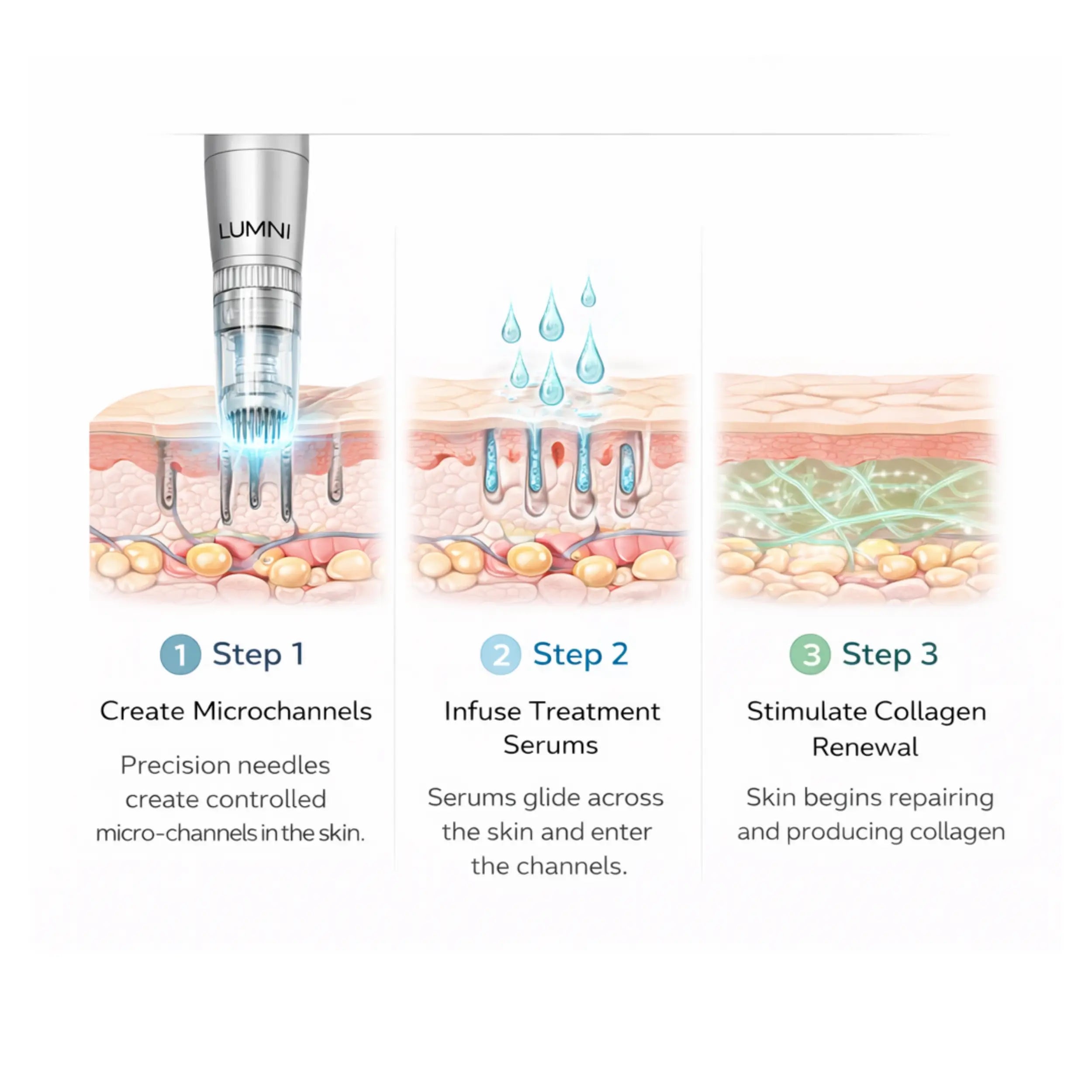 MicroNeedling Pen