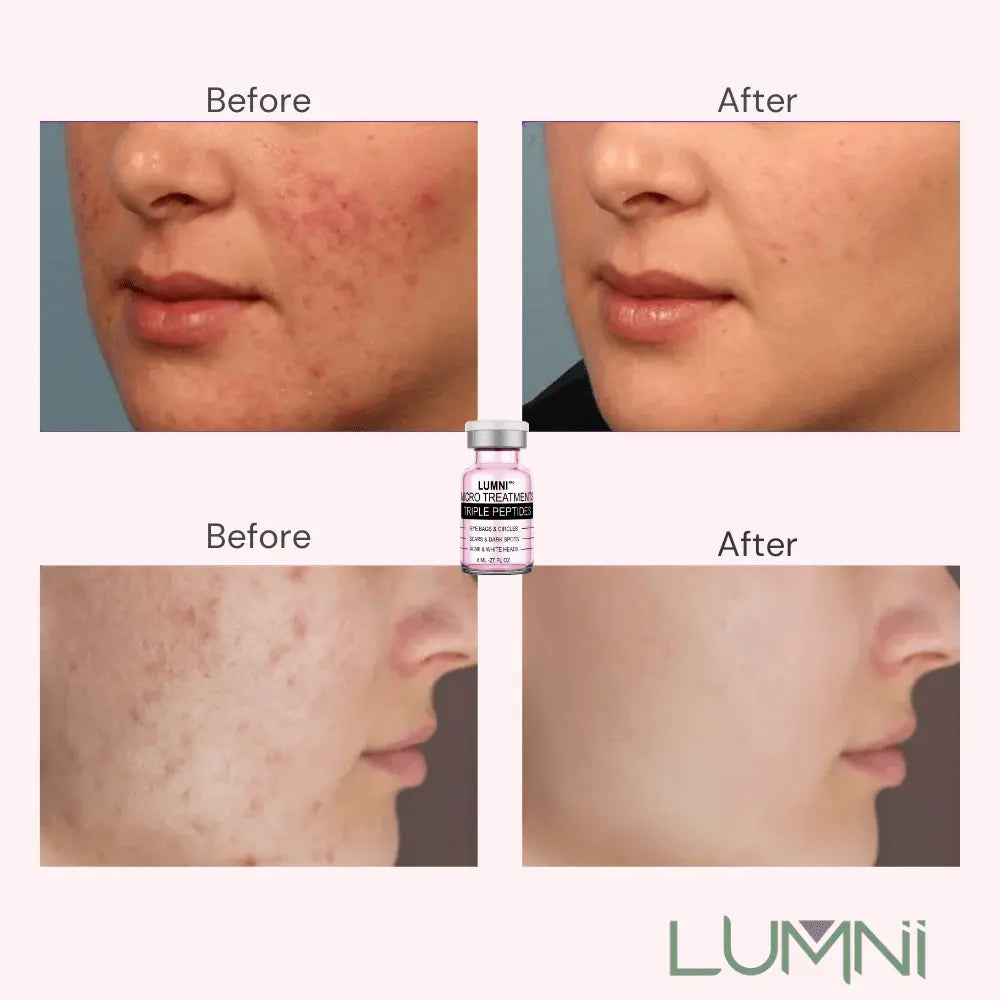 Microneedling Serum Peptide - LushnLavish.com
