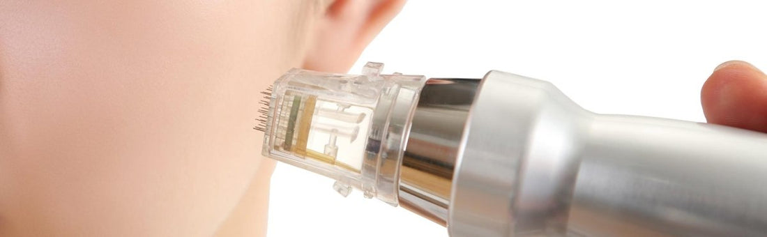 What is the Best Microneedling Device for Radiant Skin? - LushnLavish.com