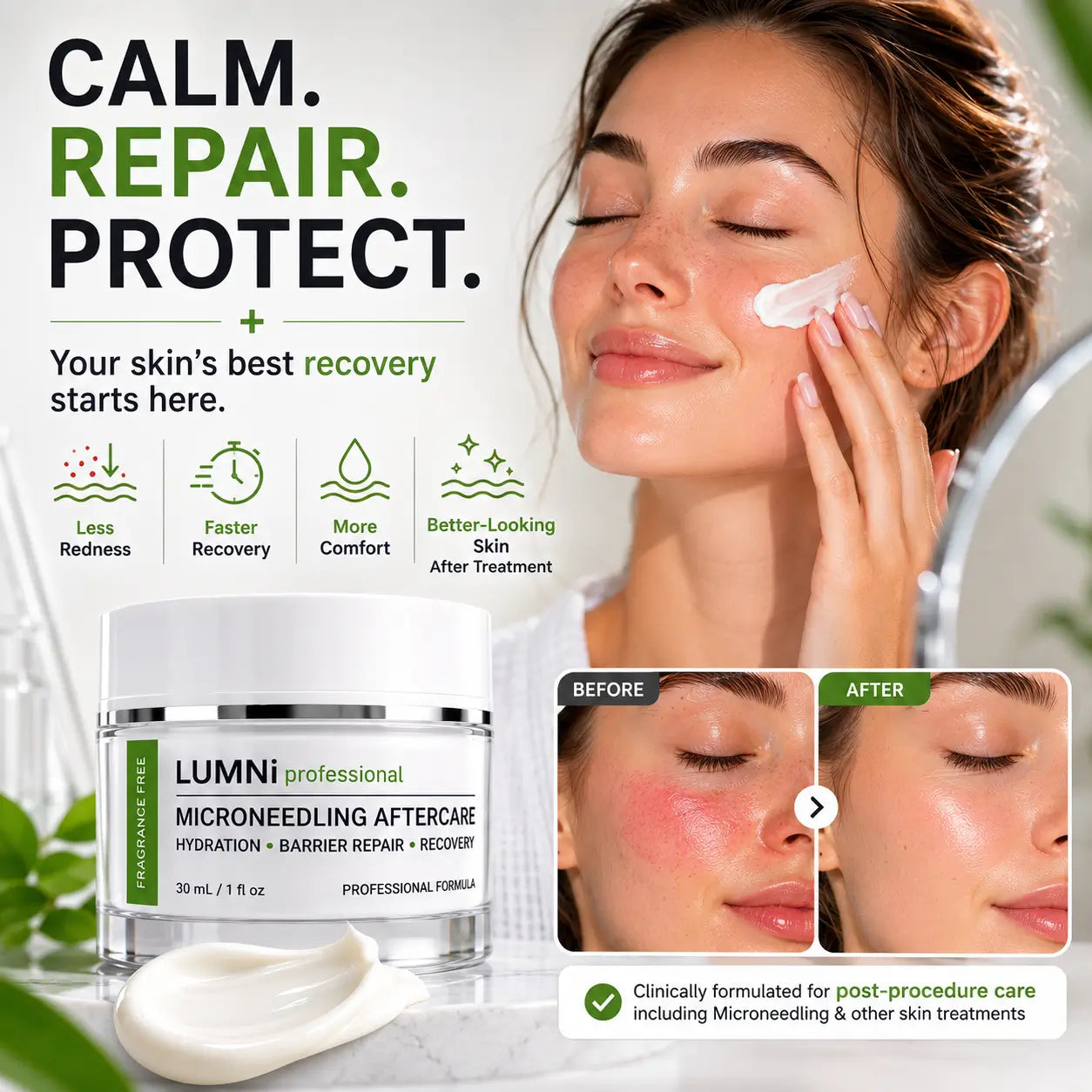 Woman applying LUMNi Microneedling Aftercare Cream after a microneedling treatment