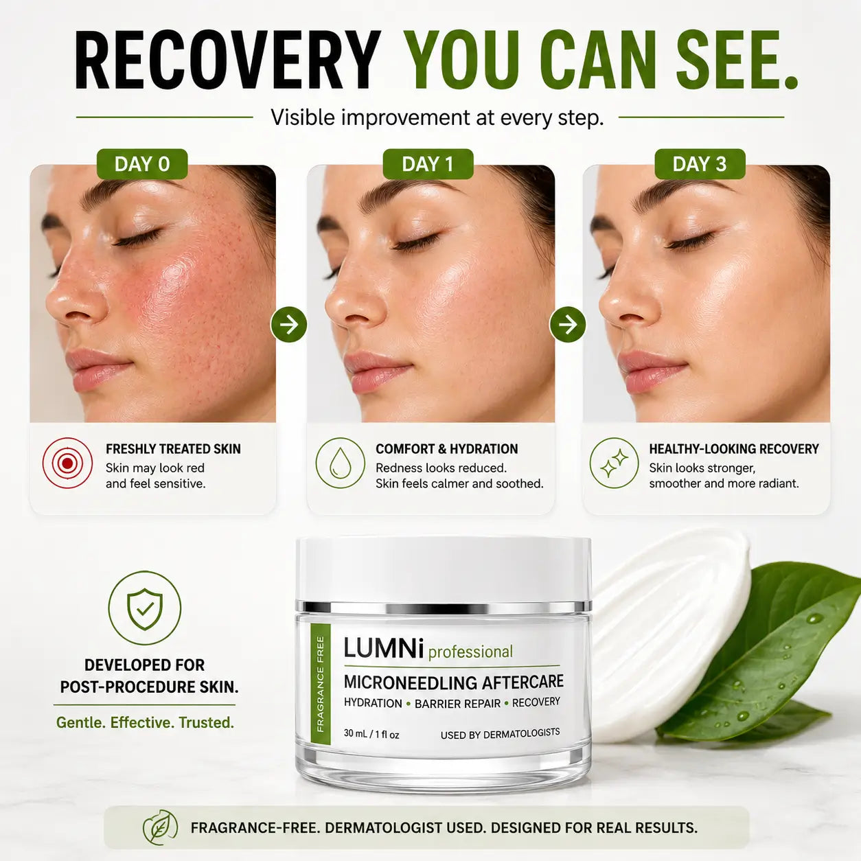 Recovery timeline showing skin appearance from Day 0 to Day 3 after microneedling with aftercare support